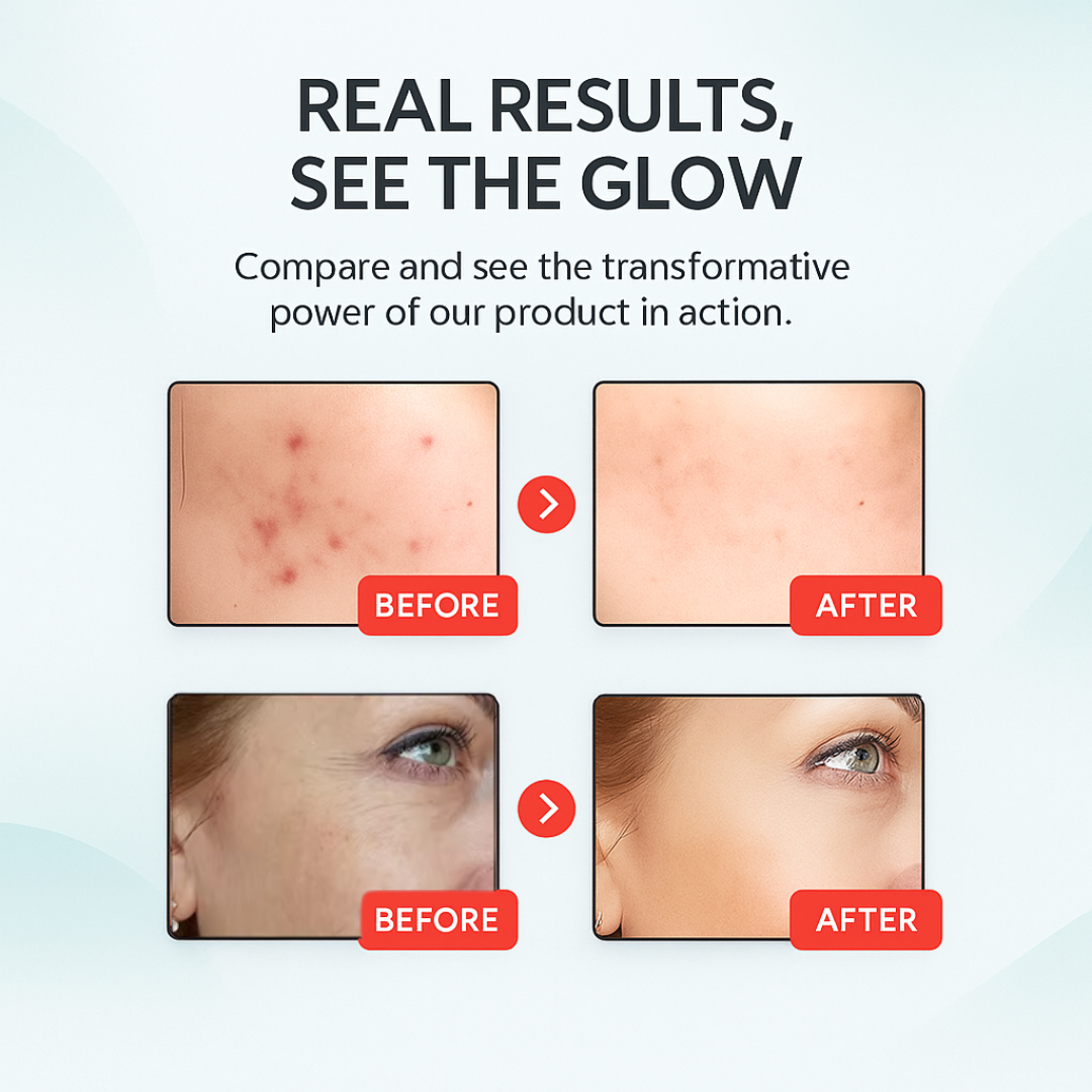 Wireless Red Light Therapy Face Mask